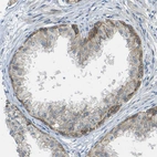 Immunohistochemical staining of human prostate shows weak to moderate membranous positivity in glandular cells.