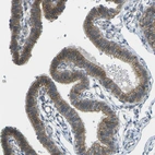 Immunohistochemical staining of human fallopian tube shows strong membranous positivity in glandular cells.