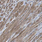 Immunohistochemical staining of human prostate shows moderate cytoplasmic positivity in smooth muscle cells.