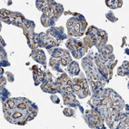 Immunohistochemical staining of human placenta shows moderate cytoplasmic positivity in endothelial cells.