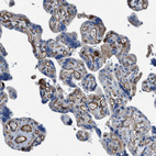 Anti-SLC6A9 Antibody