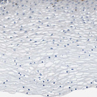 Immunohistochemical staining of human cervix, uterine shows no positivity in squamous epithelial cells as expected.