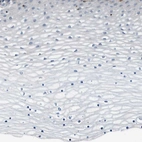 Immunohistochemical staining of human cervix, uterine shows no positivity in squamous epithelial cells as expected.