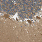 Anti-CYTH3 Antibody