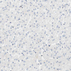 Immunohistochemical staining of human liver shows no positivity as expected.