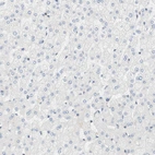 Immunohistochemical staining of human liver shows no positivity as expected.