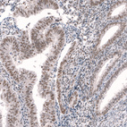 Anti-RBM7 Antibody