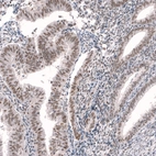 Anti-RBM7 Antibody