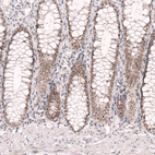 Immunohistochemical staining of human colon shows moderate nuclear positivity in glandular cells.