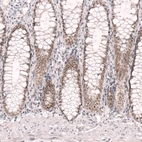 Immunohistochemical staining of human colon shows moderate nuclear positivity in glandular cells.