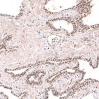 Immunohistochemical staining of human prostate shows moderate nuclear positivity in glandular cells.