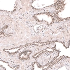 Immunohistochemical staining of human prostate shows moderate nuclear positivity in glandular cells.