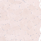 Immunohistochemical staining of human skeletal muscle shows no nuclear positivity in striated muscle fibers as expected.