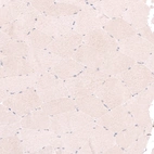 Immunohistochemical staining of human skeletal muscle shows no nuclear positivity in striated muscle fibers as expected.