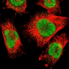 Immunofluorescent staining of human cell line U-251 MG shows localization to nucleus.