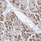 Anti-NEBL Antibody