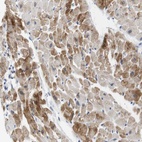 Anti-NEBL Antibody