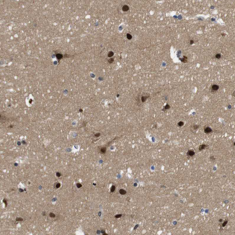 Anti-ZBTB46 Antibody