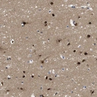 Anti-ZBTB46 Antibody