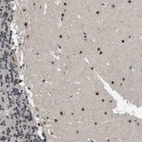 Immunohistochemical staining of human cerebellum shows strong nuclear positivity in cells in molecular layer.