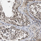 Immunohistochemical staining of human testis shows strong nuclear positivity in cells in seminiferous ducts.