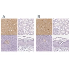 Immunohistochemical staining of human cerebral cortex, kidney, pancreas and skin using Anti-NECAB2 antibody HPA013998 (A) shows similar protein distribution across tissues to independent antibody HPA014144 (B).