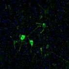 Immunofluorescence staining of mouse facial nucleus shows distinct positivity in neuronal cell bodies and processes.