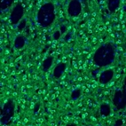 Immunofluorescence staining of mouse caudate putamen shows immunoreactivity in medium spiny neurons and synapses.