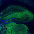 Immunofluorescence staining of mouse hippocampus shows immunoreactivity in a subset of neurons,
