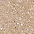 Immunohistochemical staining of human cerebral cortex shows strong cytoplasmic positivity in a subset of neurons, as well as moderate positivity in neuropil.