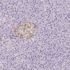 Anti-NECAB2 Antibody