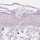 Immunohistochemical staining of human skin shows no positivity in squamous epithelial cells as expected.