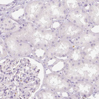 Anti-NECAB2 Antibody