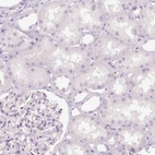 Immunohistochemical staining of human kidney showsno positivity in cells in tubules as expected.