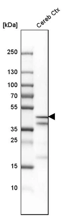 Western blot analysis in human cerebral cortex tissue.