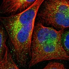 Immunofluorescent staining of human cell line U-2 OS shows localization to vesicles.