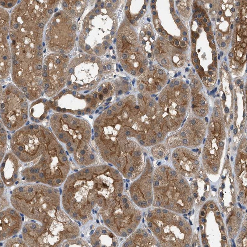Anti-GPR31 Antibody
