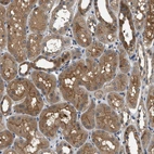 Anti-GPR31 Antibody