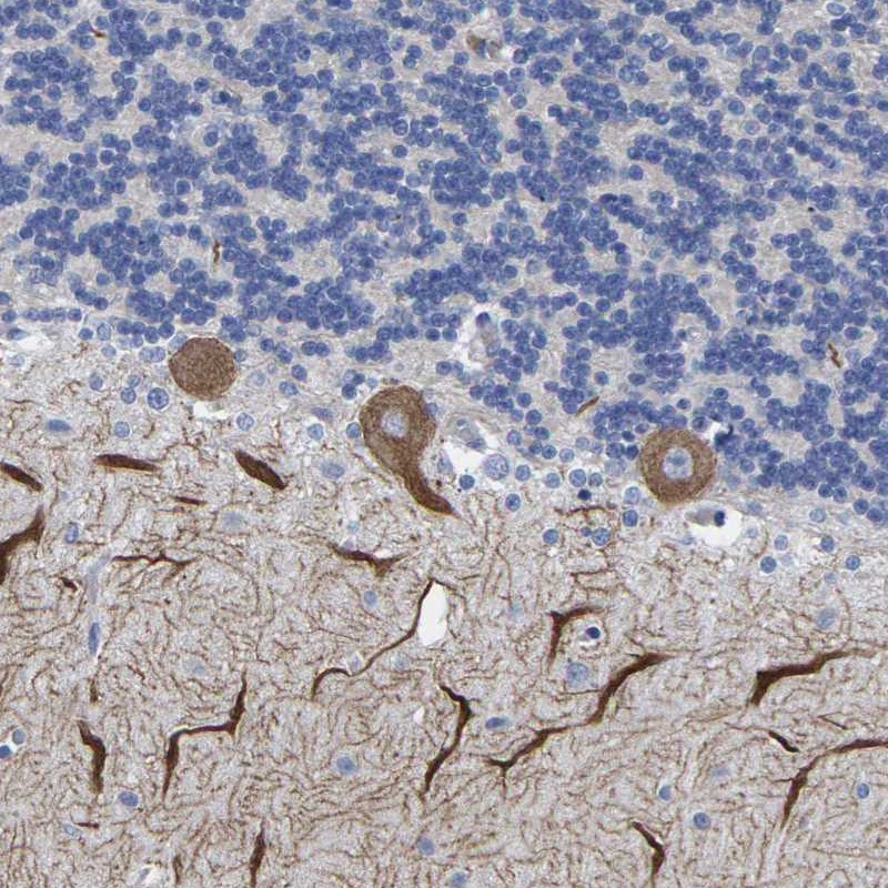 Anti-HCRTR1 Antibody