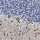 Anti-HCRTR1 Antibody