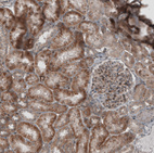 Immunohistochemical staining of human kidney shows moderate to strong cytoplasmic positivity in cells in tubules.