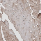 Immunohistochemical staining of human skeletal muscle shows weak positivity in myocytes as expected.
