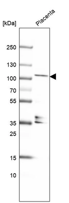 Western blot analysis in human placenta tissue.