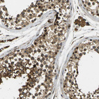 Anti-FUT11 Antibody