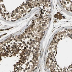 Anti-FUT11 Antibody