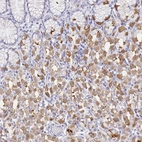 Immunohistochemical staining of human stomach shows high expression.