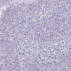 Immunohistochemical staining of human pancreas shows low expression as expected.