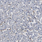 Immunohistochemical staining of human liver shows moderate membranous positivity in hepatocytes.