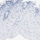 Immunohistochemical staining of human cervix shows no positivity in squamous epithelial cells as expected.