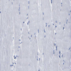 Immunohistochemical staining of human skeletal muscle shows no positivity in myocytes as expected.